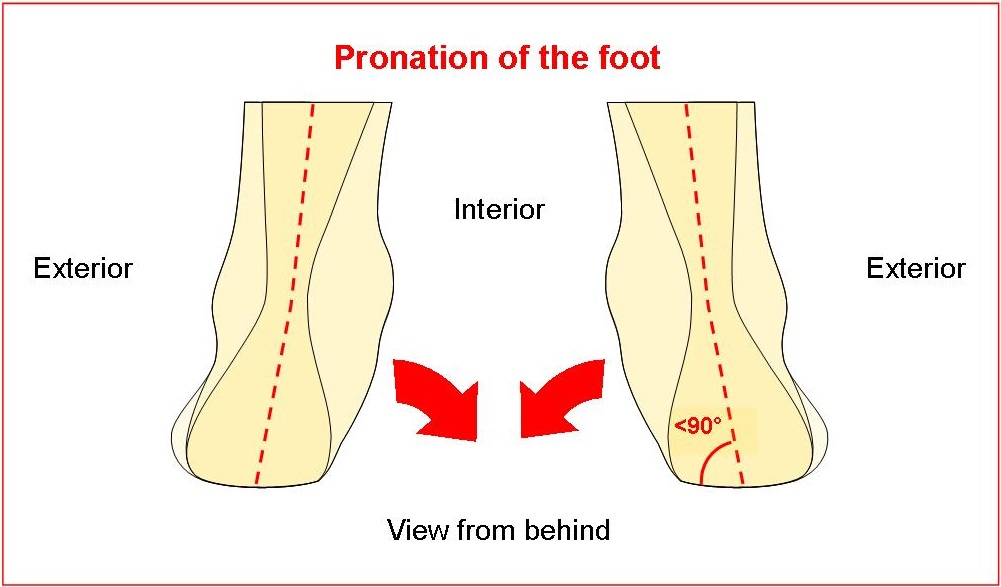 Heel pronation best sale